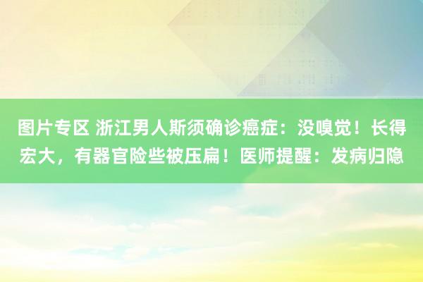 图片专区 浙江男人斯须确诊癌症：没嗅觉！长得宏大，有器官险些被压扁！医师提醒：发病归隐